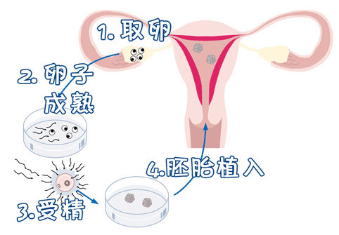 好韵多次失败疑难中心